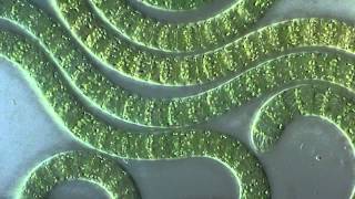 Cyanobacteria under microscope [upl. by Ardra]