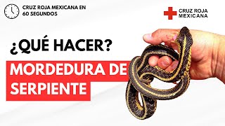 ¿Cómo tratar una mordida de serpiente PrimerosAuxilios [upl. by Seditsira794]