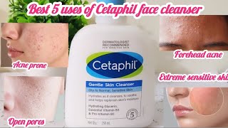 Best 5 uses of Cetaphil face Cleanser  before buying must watch  teenager  acne prone 👍 [upl. by Janette]