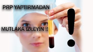 PRP Yaptırmadan Önce Bilmeniz Gereken Konular MUTLAKA İZLEYİN [upl. by Marten269]