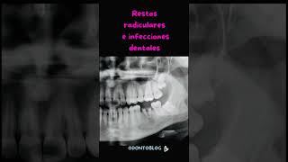 Rx Panorámica dental odonto shorts retoshorts30 rx panoramica dental [upl. by Sabra]