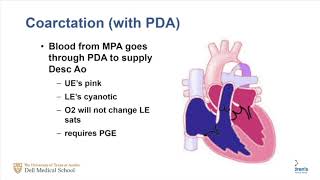 Approach To The Infant With Cyanotic Congenital Heart Disease [upl. by Yelnahs]