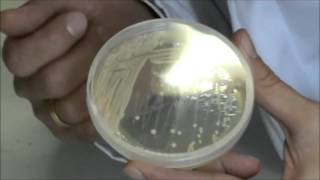 Técnicas básicas de Microbiología Apariencia de Saccharomyces cerevisiae en cultivo puro [upl. by Gladys119]