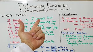 Pulmonary embolism management wells criteria  treatment options and duration [upl. by Nakeber]