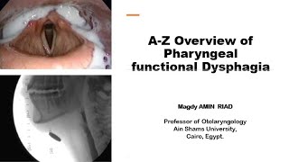 A Z Overview of Pharyngeal functional Dysphagia [upl. by Gawen626]