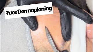 Dermaplaning Treatment facial dermaplaning satisfying beauty aesthetics blackheadremoval [upl. by Irolav781]