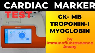 CARDIAC MARKER TEST  TRIPLE MARKER TEST CKMB TROP I MYOGLOBIN USING ACCUREX ACCU Dx Cq [upl. by Dreda41]