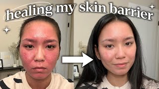 how i repaired my skin barrier not sponsored [upl. by Eanahc]