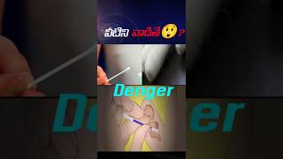 వీటిని వాడితే🥶quotEar Cleaning Secrets Are Cotton Sticks Safefacts [upl. by Yenolem240]