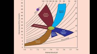 Part 2 Acidosis and Alkalosis Metabolic or Respiratorymp4 [upl. by Ailimac873]