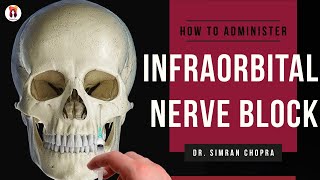 Infraorbital Nerve Block l How To Give Infraorbital Nerve Block l Nerve Block Injection [upl. by Atterbury]