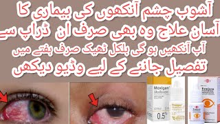 Moxigan amp femicon eye drops uses in urdu l best for eyes infection and itching by aneespharmacist [upl. by Atiuqrehs813]