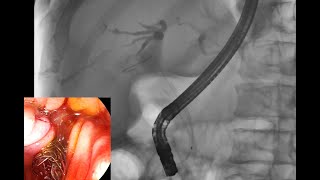 FLORIDA LIVE AUGUST 2224 2024 EDUCATIONAL VIDEO ROLE OF SLIM DUODENOSCOPES IN PRACTICE OF ERCP [upl. by Magdau]