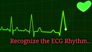 Identify the ECG Rhythm  EKG Interpretation [upl. by Noel395]