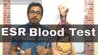 ESR test in Hindi erythrocyte sedimentation rate test [upl. by Ivar]