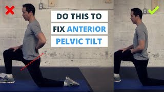 6 Minute Routine to Correct ANTERIOR Pelvic Tilt [upl. by Srini]