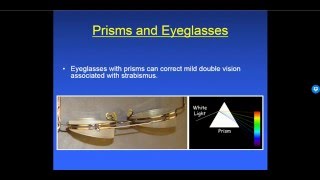 Diplopia 66  Treatment [upl. by Lehman]