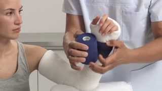 Plaster of Paris Elbow Splint Application [upl. by Kery]