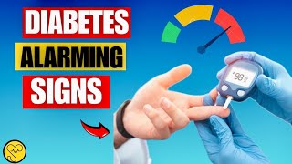 10 Alarming Signs Your Blood Sugar Is Too High by Vitalhealth6 [upl. by Aitnis2]