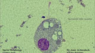 Sperm morphologyRound cells [upl. by Melinda]