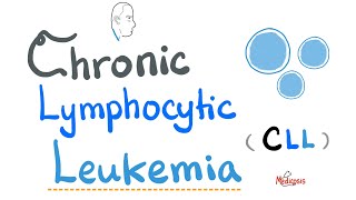 Chronic Lymphocytic Leukemia CLL  Etiology Risk Factors Symptoms Signs Diagnosis Treatment [upl. by Inacana]