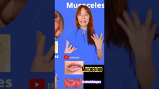 mucoceles mucocele dentista odontología odontologia shorts odontoblog odontoblogmx [upl. by Niamrej]