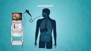 Gastrocopy [upl. by Carol]