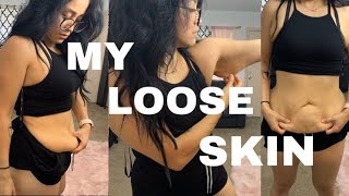 LOOSE SKIN AFTER 100 POUND WEIGHT LOSS [upl. by Rhine]