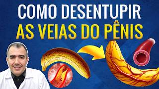 Como desentupir as veias do pênis para ter melhores ereções [upl. by Maddy]