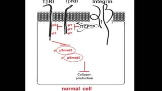 Unraveling profibrotic pathways in the kidney [upl. by Zeph]