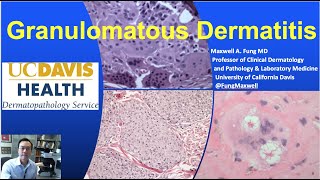 DERMATOPATHOLOGY Granulomatous Dermatitis [upl. by Oiramed226]