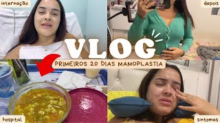 DIÁRIO DA MAMOPLASTIA REDUTORA  vlog dia da cirurgia PÓS OPERATÓRIO recuperação e sintomas 2 [upl. by Gathers]