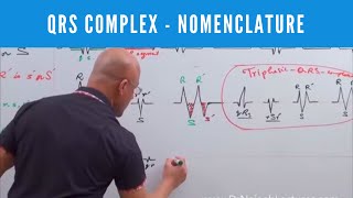 ECG  QRS Complex in EKG  Nomenclature  Electrocardiography🫀 [upl. by Chaddy]