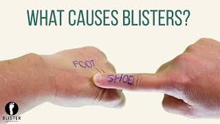 What Causes Blisters On Feet [upl. by Danica]