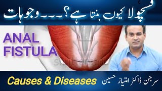 Causes of Perianal Fistula  Most common cause of fistula formation  Surgeon Dr Imtiaz Hussain [upl. by Muriel]