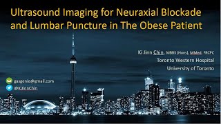 Ultrasound Imaging in Obesity for Epidural  Spinal Anesthesia amp Lumbar Puncture [upl. by Ted]