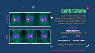ENDOCRINOLOGÍA Nódulo tiroideo [upl. by Teloiv]