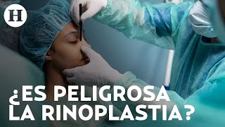 ¿No te gusta tu nariz La rinoplastia es la cirugía plástica más común conoce riesgos y cuidados [upl. by Kissee]