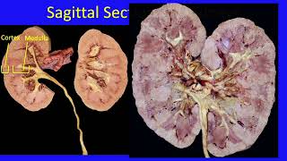 Anatomy of the Abdomen 89 Retroperitoneal Organs [upl. by Ominoreg136]