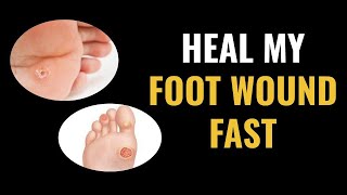 How Do I Heal My Foot Wound Fast  Introduction [upl. by Pittel]