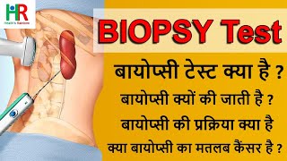 what is biopsy test in hindi  Why biopsy is done  Biopsy procedure  बायोप्सी क्यों की जाती है [upl. by Gerbold878]