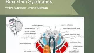 Brainstem Localization [upl. by Spindell954]