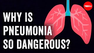 Why is pneumonia so dangerous  Eve Gaus and Vanessa Ruiz [upl. by Ojillib]