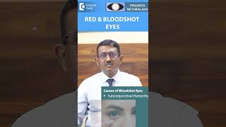 Red Eyes amp Bloodshot Eyes Causes of Red Eye amp DiagnosisDrSriram RamalingamDoctors Circleshorts [upl. by Ibrik]