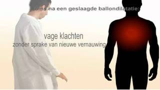 Ballondilatatie  Wat is het en gaat het in zijn werk [upl. by Welby137]