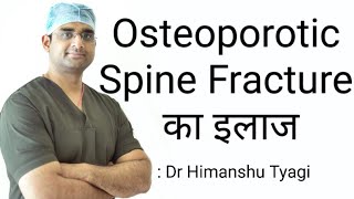 osteoporotic Spine Fracture का इलाज treatment [upl. by Aramanta]