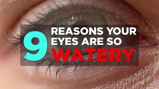 Heres Why Your Eyes Water All the Time  Dry Eye Disease and Watery Eyes [upl. by Svetlana962]