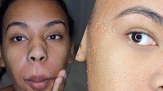 How to get rid of dry skin Literally RUB all the DEAD SKIN off your FACE [upl. by Bekki]