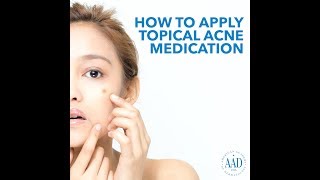 How to apply topical acne medication [upl. by Bennion448]