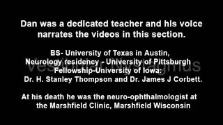 Vestibular Nystagmus 215 [upl. by Cary]